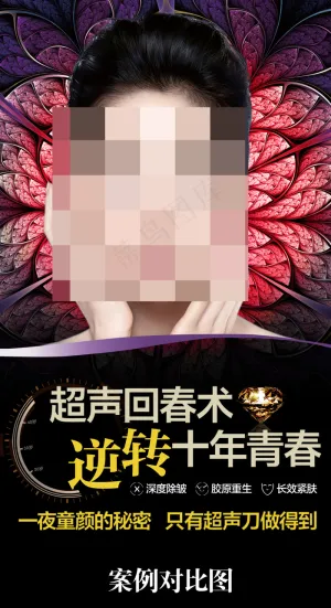 超声刀除皱抗衰老X展架超声刀