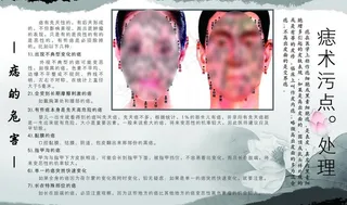 痣术污点处理图片