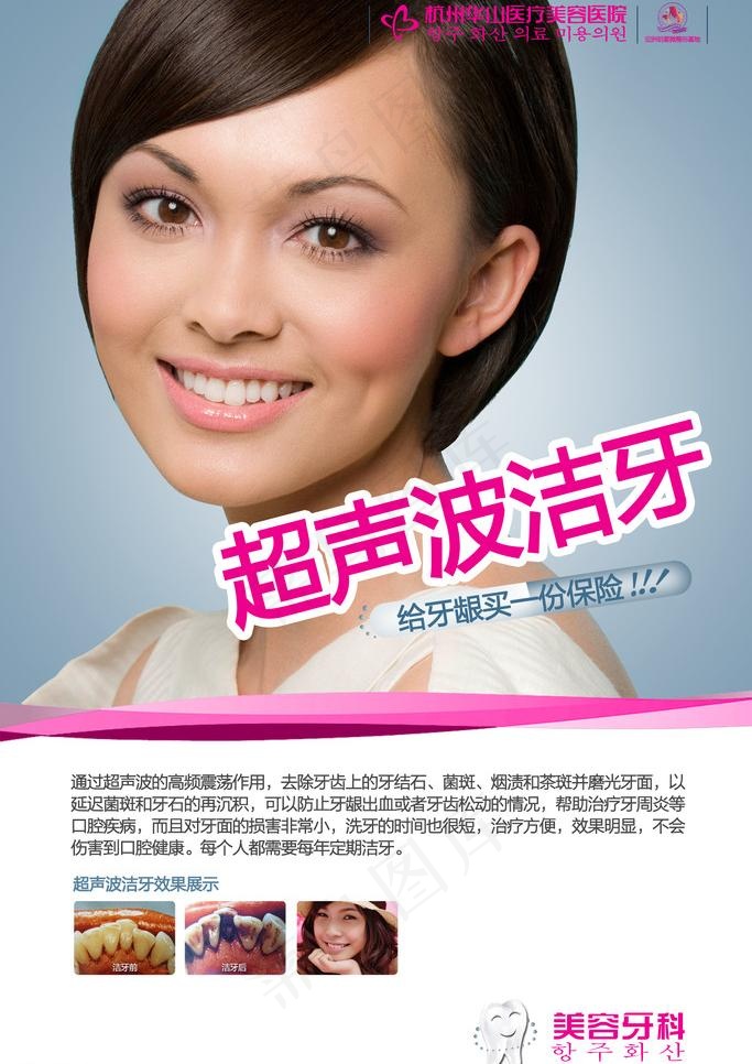 口腔牙齿美容（超声波洁牙）图片