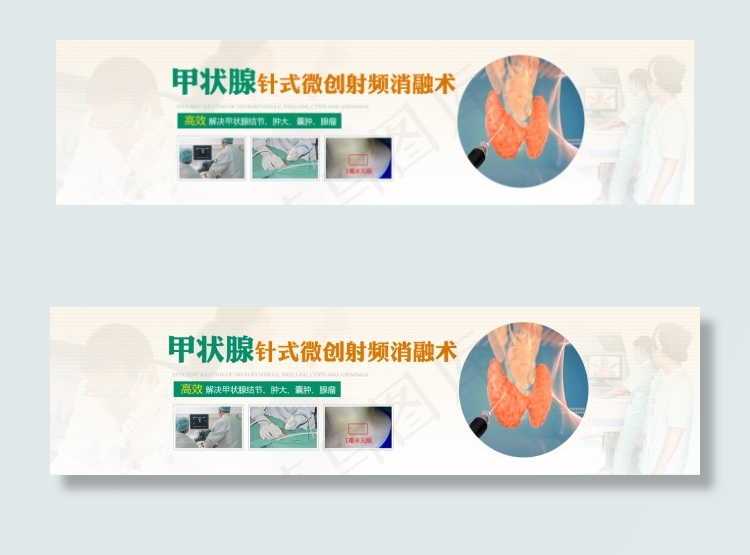 甲状腺针式微创术