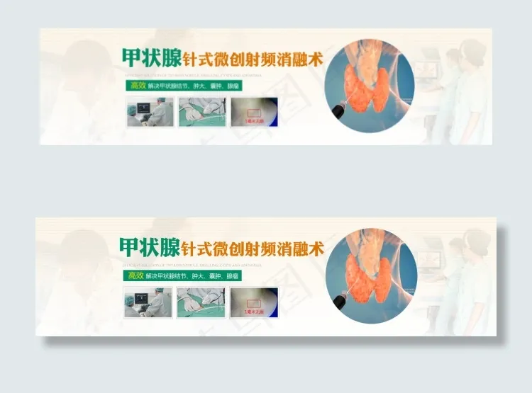 甲状腺针式微创术psd模版下载