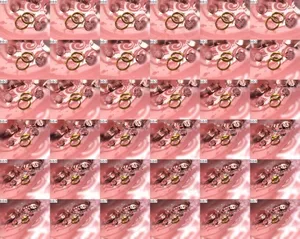 粉色戒指
