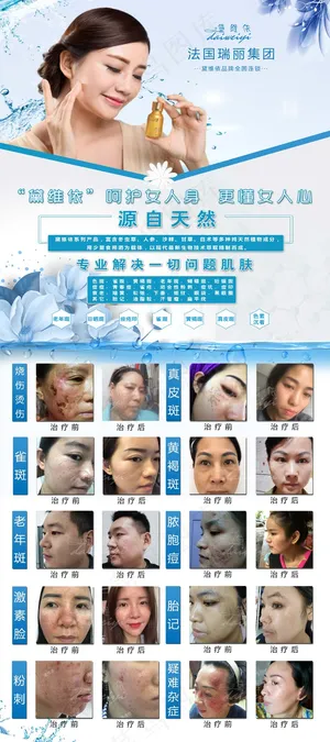 祛斑 祛痘  美容前后对比图  