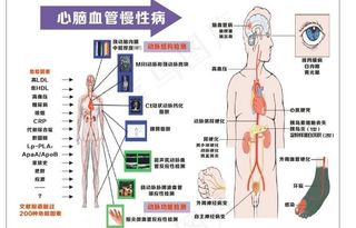 心脑血管慢性病图片