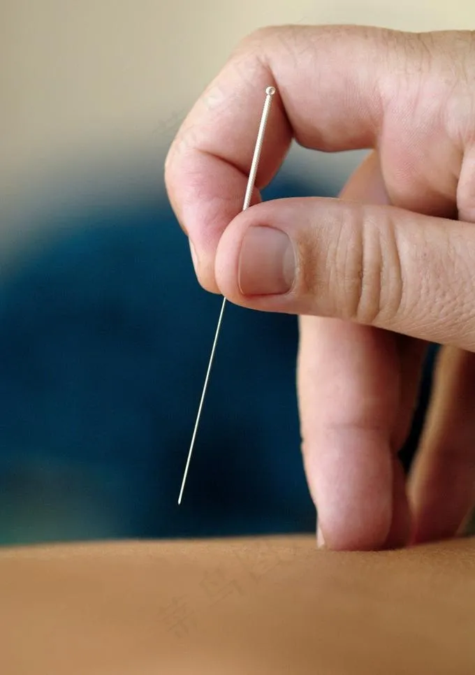 中医针灸图片