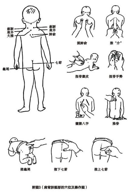 肩背部穴位图图片