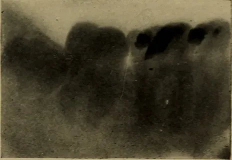 图片来自“失眠和神经紧张”（1908年）第32页