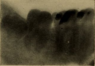 图片来自“失眠和神经紧张”（1908年）第32页