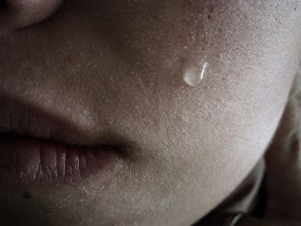 手,腱鞘囊肿,人脸,酒糟鼻,荨麻疹,拉格拉马斯－德佩拉