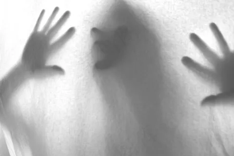 婴儿,咬翼片,关节X线照片,人脸,糖果,被困 婴儿,咬翼片,关节X线照片,人脸,糖果,被困