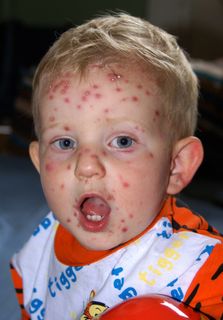 第6天下午6点-牛奶后