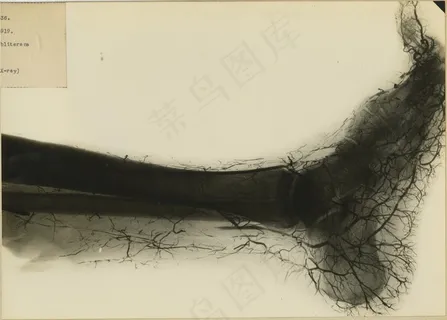 里夫043536 里夫043536