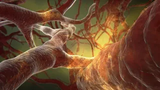 登革热病毒感染