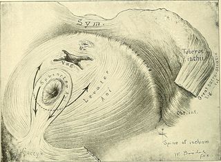 钢笔画,简笔画,绘画,版画,素描,图片来自“手术妇科：”的第107页（1906年）