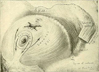钢笔画,简笔画,绘画,版画,素描,图片来自“手术妇科：”的第107页（1906年）