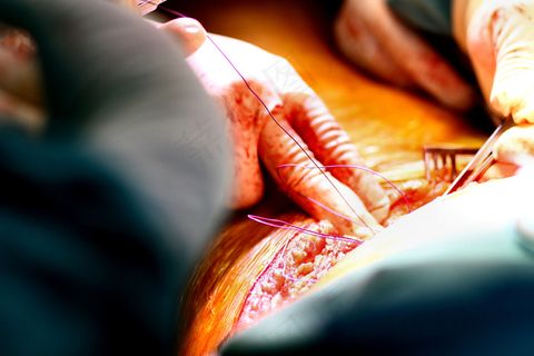 医学/外科手术摄影