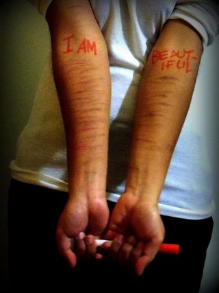 手指,手,雪茄,工艺品,烫伤,我很漂亮