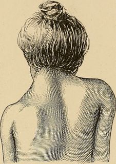 图片来自“矫正体操地图集：尾翼的背叛； 51个足足的209个数字，以及53个数字的文本”（1903年）