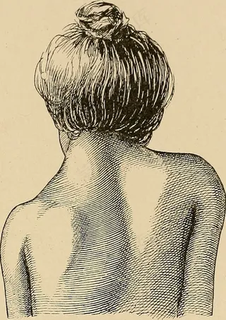 图片来自“矫正体操地图集：尾翼的背叛； 51个足足的209个数字，以及53个数字的文本”（1903年）