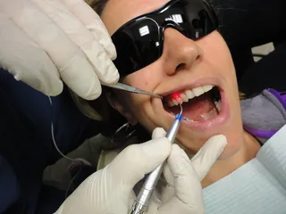 使用BIOLASE ezlase 940激光在安大略省万锦市的牙科手术中