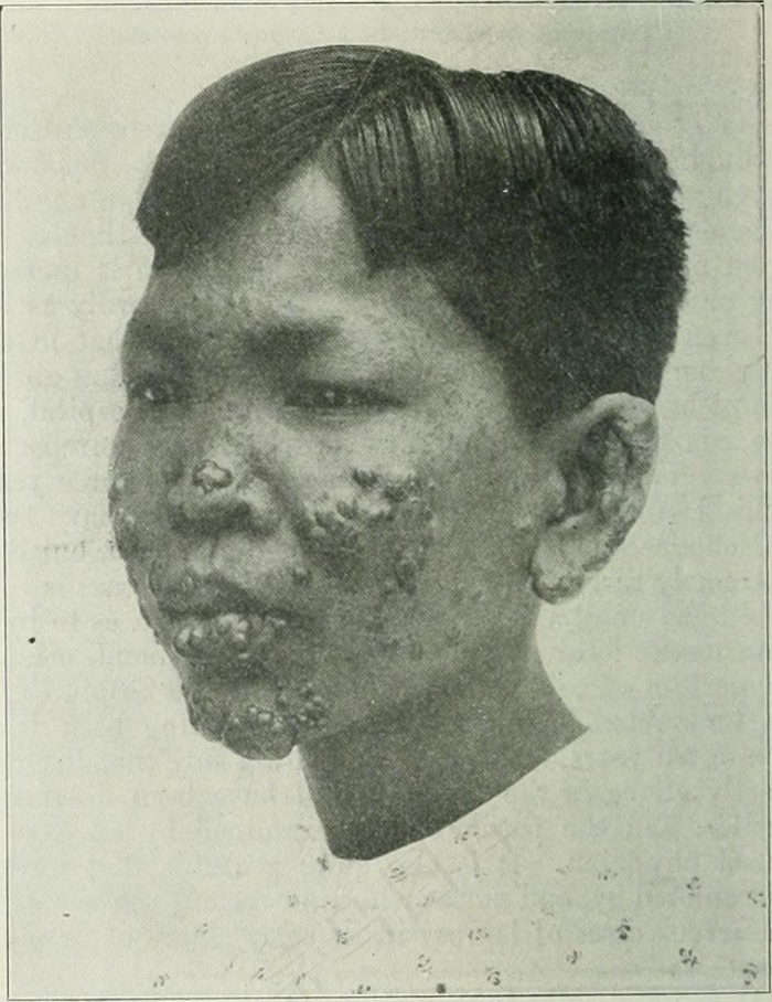 图片摘自《美国医学会杂志》（1883年）第325页