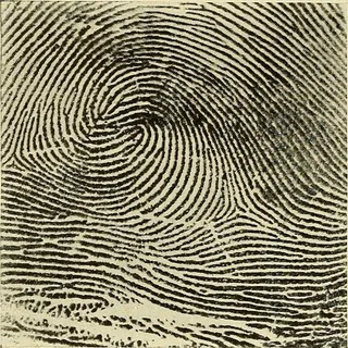 图片来自“个人识别；用于识别生死者的方法”的第329页（1918年）