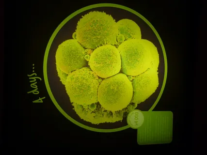 4天的人类胚胎（x4000放大倍数）