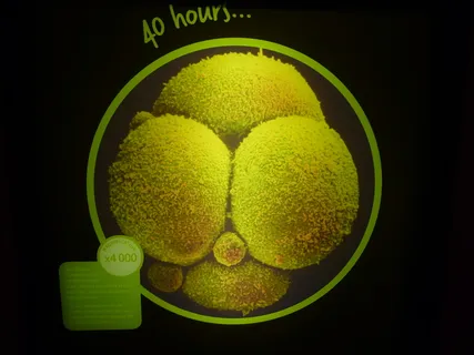 40小时后的人类胚胎（x4000放大倍数）
