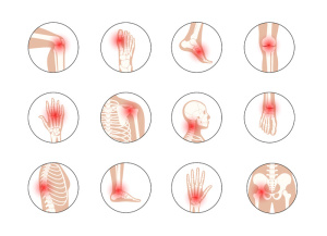 类风湿性关节炎、疼痛、骨病概念。