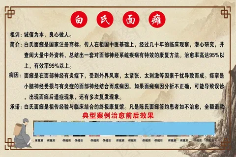 白氏面瘫展板海报