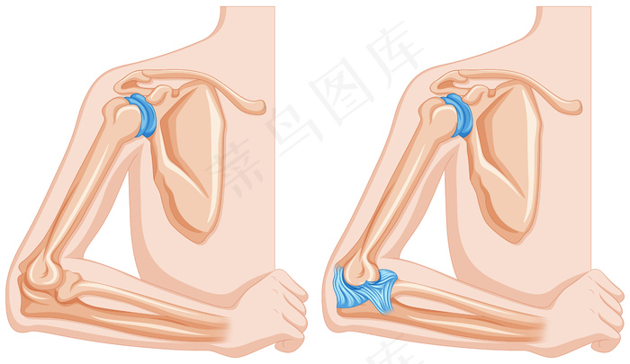 肘关节X线eps,ai矢量模版下载