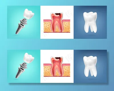 人体牙齿解剖插图的写实设计