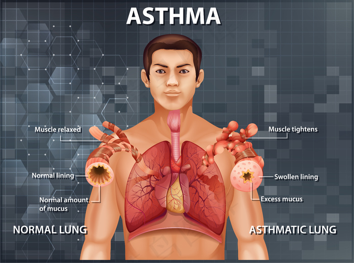 健康肺与哮喘肺的比较eps,ai矢量模版下载
