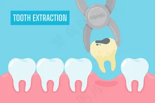 拔牙。卡通黄色牙齿，牙垢和牙菌斑从口腔中去除。