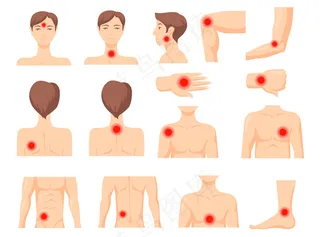 疼痛的焦点。人体部位有红斑，肌肉或关节疼痛