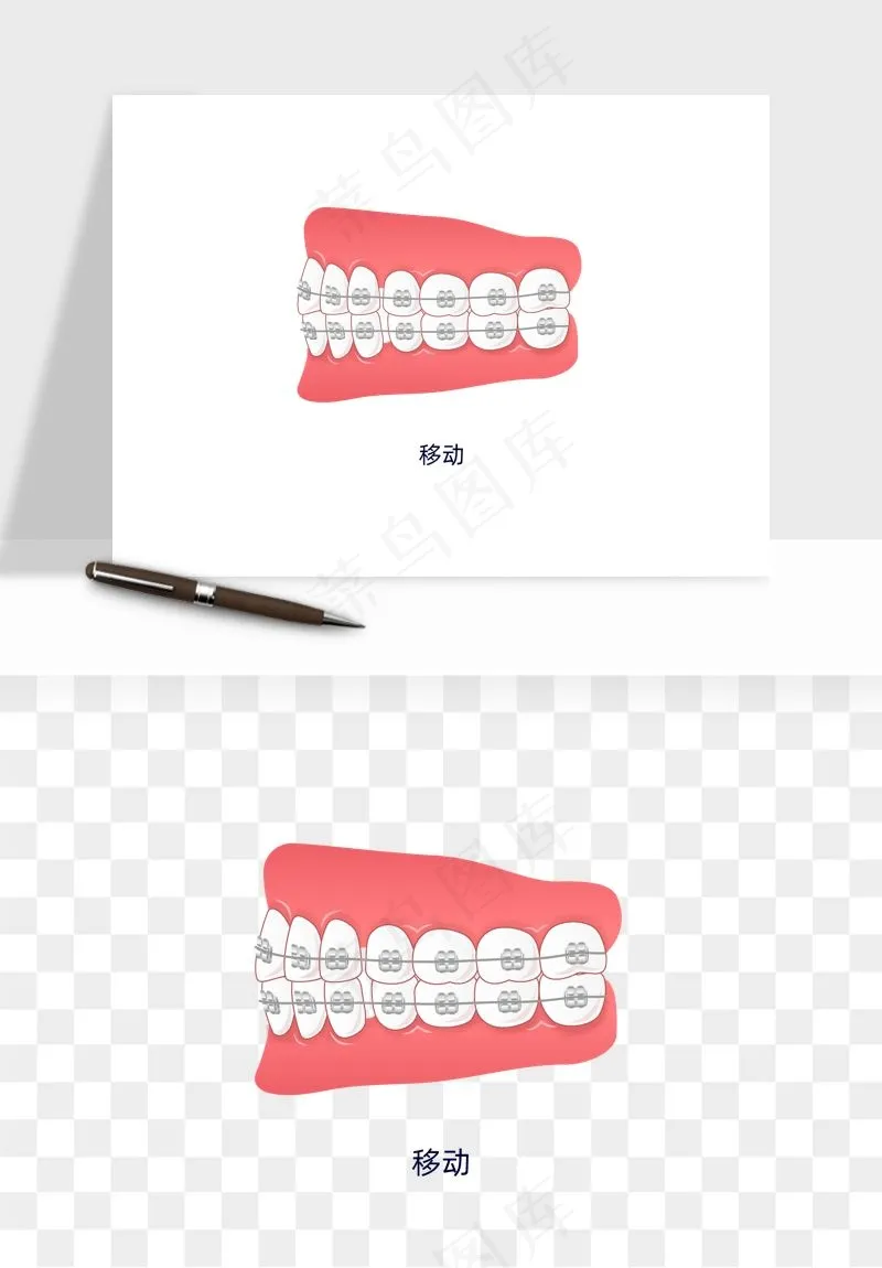 手绘牙齿矫正拔牙png免抠