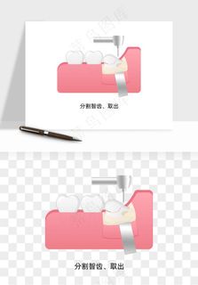 手绘牙齿矫正拔牙png免抠