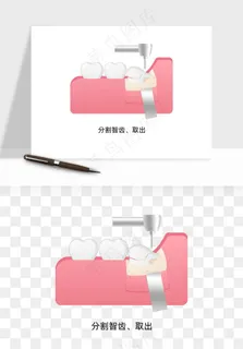 手绘牙齿矫正拔牙png免抠