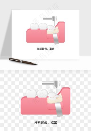 手绘牙齿矫正拔牙png免抠