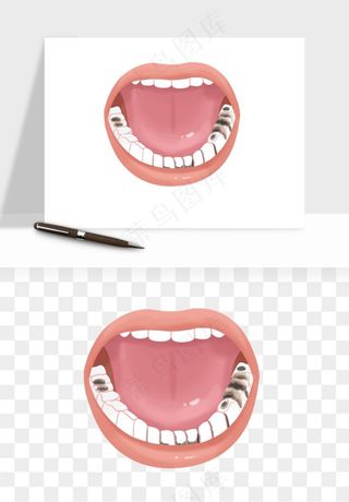手绘牙齿矫正拔牙png免抠