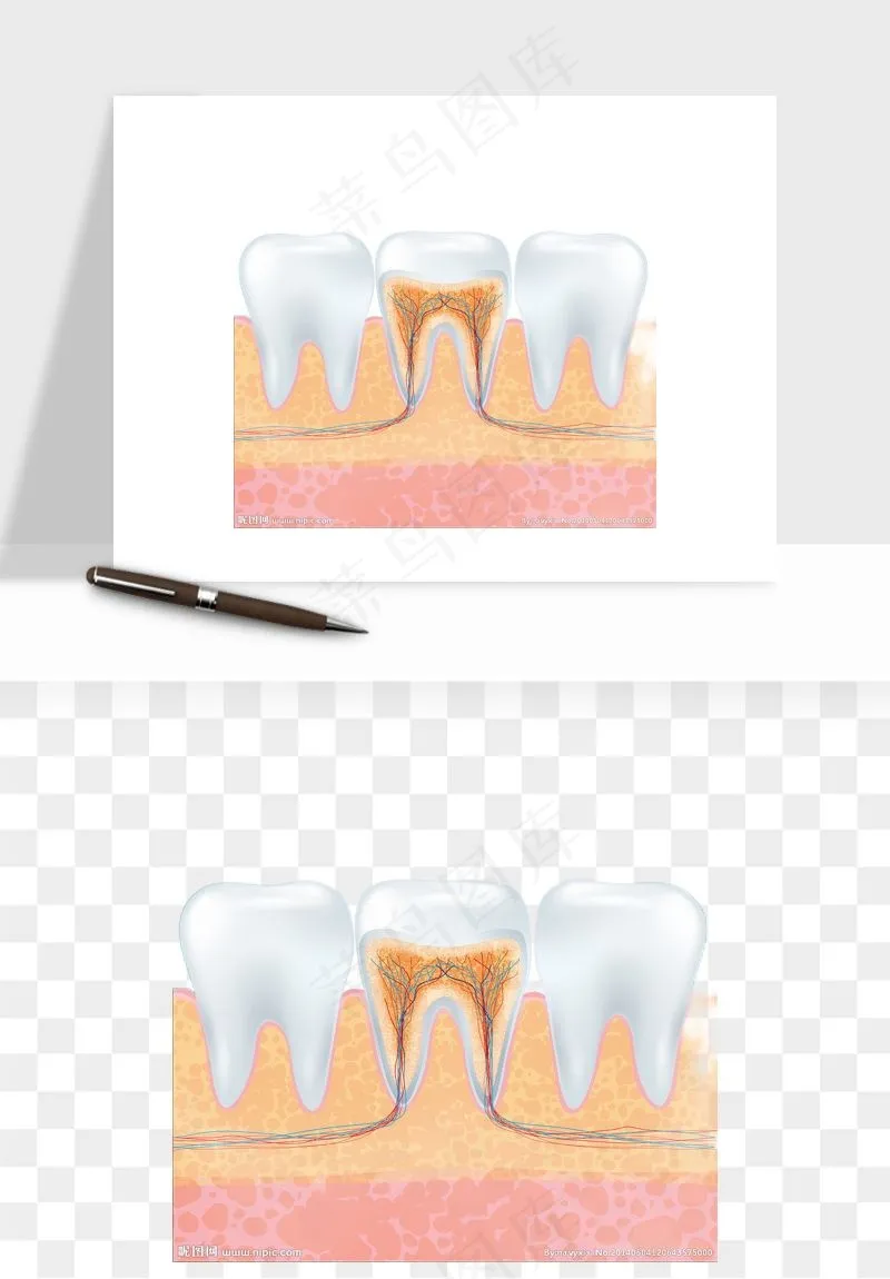 手绘牙齿矫正拔牙png免抠