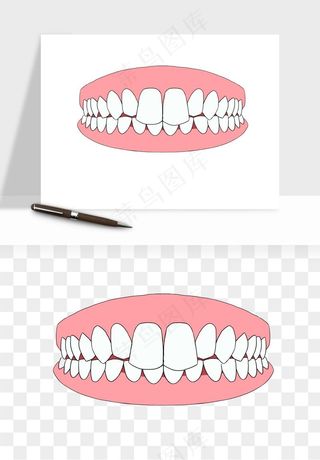 手绘牙齿矫正拔牙png免抠