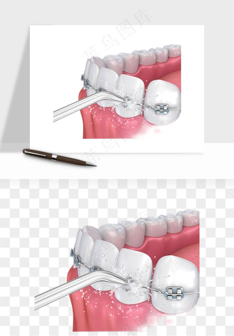 手绘牙齿矫正拔牙png免抠