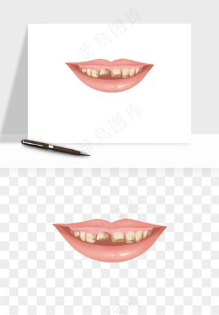 手绘牙齿矫正拔牙png免抠