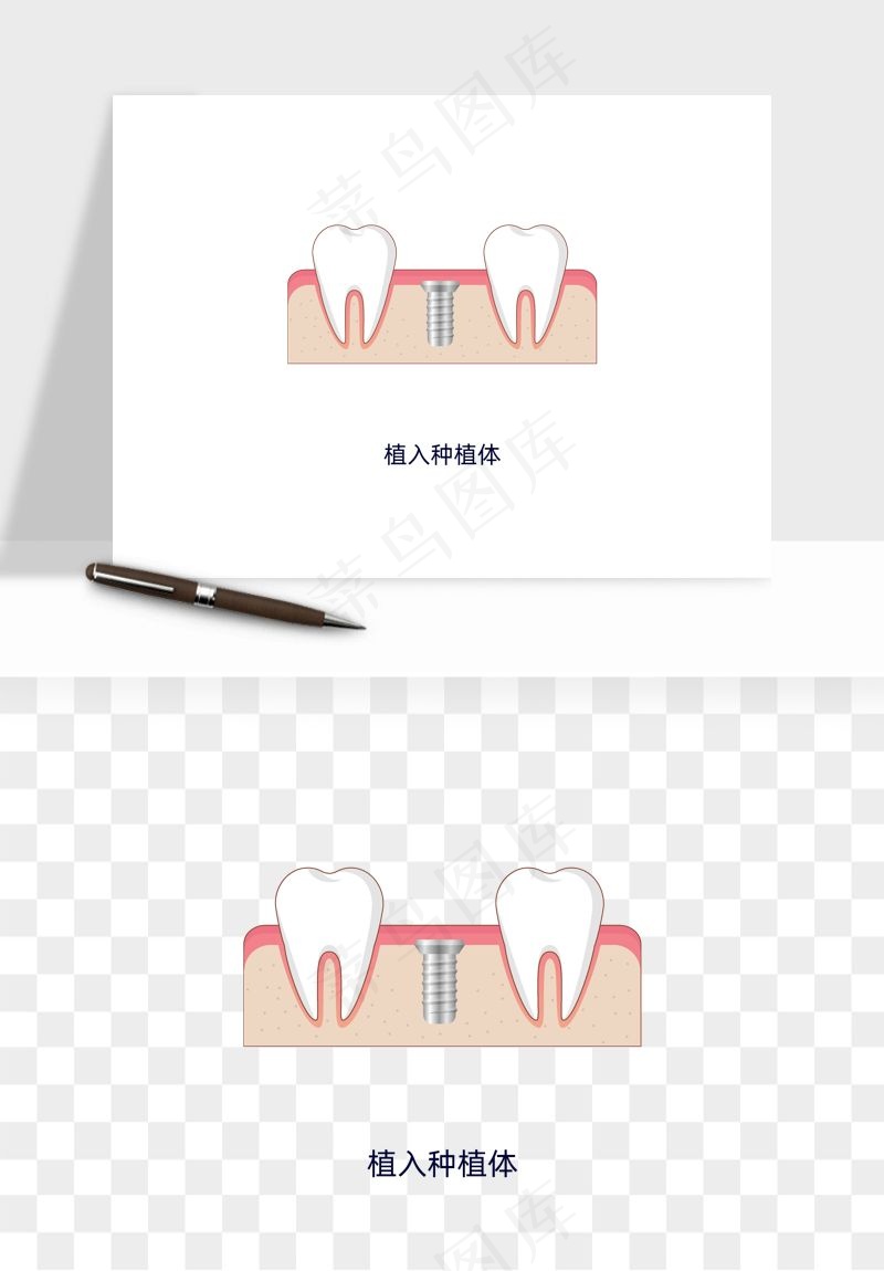 手绘牙齿矫正拔牙png免抠