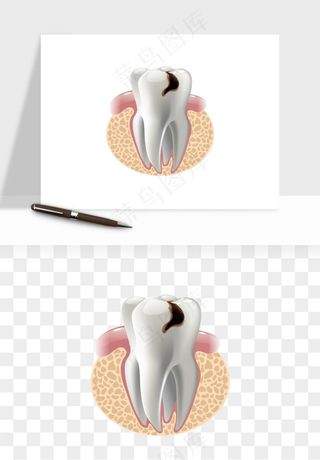 手绘牙齿矫正拔牙png免抠