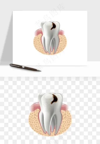 手绘牙齿矫正拔牙png免抠