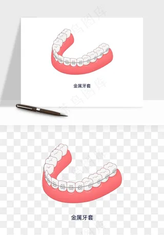 手绘牙齿矫正拔牙png免抠