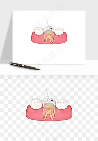 手绘牙齿矫正拔牙png免抠