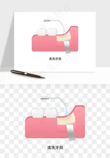 手绘牙齿矫正拔牙png免抠